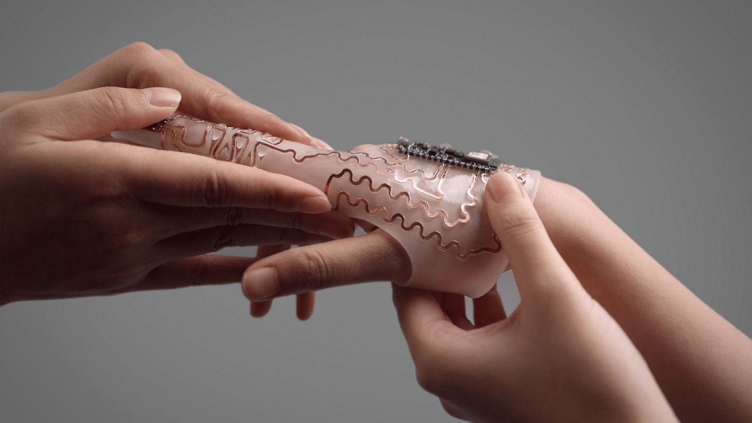 A finger extension splint with 3D high-density spring for rehabilitation training.